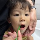 치과위생사 엄마가 고른 래디어스칫솔, 3살 6살 아기칫솔추천 후기
