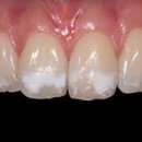 대화반점 이미지