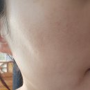 힐바이오 | 바이오힐보 콜라겐 리모델링 세럼 사용 후기 ❤️