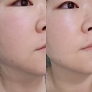 청담샵추천 토너패드｜여름 피부 열감에 좋았던 윤하정 추천 테카테카 토너패드 후기