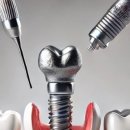 향기로운치과의원 이미지