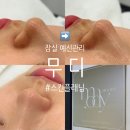 잠실어린이집 | [잠실 예신관리/무디] 화잘먹 물광 피부 저자극 스킨플래닝 후기