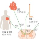 건강한당신"연관통" 이미지