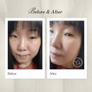 더유파트너스 | 다크써클과 눈 밑 꺼짐이 신경 쓰일 때이스프렌 아이헬프유 패치 솔직 후기