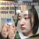강남여드름관리 양재 턱드름 여드름 압출 미앤미스킨앤바디 이지다 양재점 후기