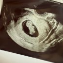 분당서울여성의원 이미지