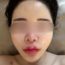 [프엔느에스테틱] 삼전동피부관리실, 촉촉함과 탄력, 물방울 리프팅으로 한 번에 채우기