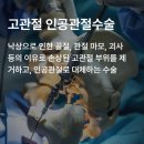 약손재활운동 이미지