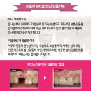 미플란트치과기공소 이미지