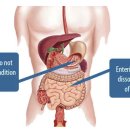인체 효소 탐구 --＞ exocrine pancreatic insufficiency --＞ 소화효소 보충제!! 이미지