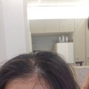 꿈미용실 | 장위동미용실 북서울꿈의숲미용실 에이바헤어 뿌리염색 후기