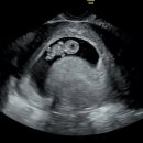 태동 | 임신 28주차 기록! 입덧부터 태동까지, 중기 증상,임당검사,태동 솔직 후기