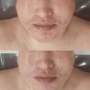 아린뷰티온