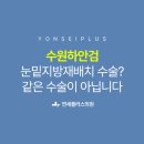 연세더바로성형외과의원 네이버블로그