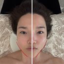 잠실우성아파트(1동뒤) | 잠실/송파윤곽관리, 쥬브니크에서 경험한 100% 기기 관리의 신세계! (더 코어 시그니처 후기)