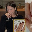 아이비헬스 이미지