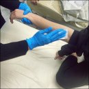 광뷰티 의료기기 이미지