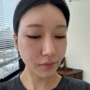 플로우케어 | 달서구에스테틱 월성동피부관리 플로우스킨 맞춤케어 후기