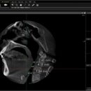 숨바로수면센터 이미지
