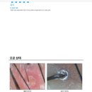 스킨앤두피
