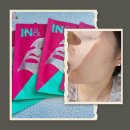 이지앤영 | 인앤아웃팩 정말 피지 빠질까? 2시간 방치 솔직 후기