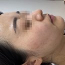 부천상동 써니뷰티 미백관리 화이트 색소관리 초 강추 후기