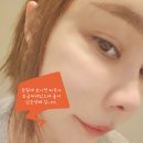 샤인피부미용 | 강남역 민앤민의원 레스노베크리스탈 MTS 로 피부재생 후기