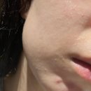 라인메디칼 - 유성구 테크노4로 17 | 서면복부관리 새얀에스테틱 복부슬리밍으로 붓기와 라인 정리 후기 재방문 테라노바관리
