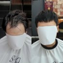 30 | 엠자이마) 커버하려고 스핀스왈로펌 했는데 앞머리가 다 끊어졌어요.. (화양동 30대 남성 탈모펌 복구후기)
