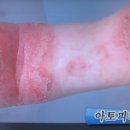 알비안녕의원 네이버블로그