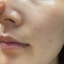 하이드라