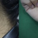 지움의원 이미지