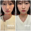 아래반송로 | 얼굴 비대칭 고민이라면? 연산역피부관리 클린스킨 관리 후기