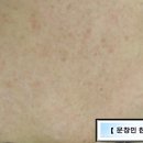 문창민한의원 이미지