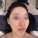 청담-143 | 당진피부관리 ❛뷰티스타❜에서 고급관리 프리즈마 받고 온 후기