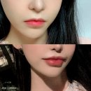 예스통상 | 자연스러운입술필러 후기는 가격에서 결정되지 않습니다 <공개>