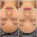 경안산소 | 부천피부관리, 올가드림뷰티 상동다정한마을점 피부해독관리 후기