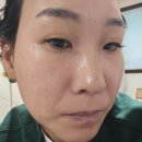 제이블랑 슈가링왁싱 | 서구 경서동 제이블랑슈가링왁싱에서 풀페이스 왁싱 + 물방울 리프팅 관리 후기