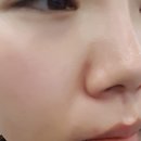 스피드메디 이미지