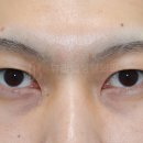 뷰라밸성형외과의원 이미지