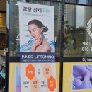 울산 신정동 피부관리, 엔케이스킨앤바디 에스테틱 리프팅 써마젯 500샷 후기
