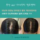 (주)다나온 | 20년차원장님 관리받고 탈모 개선되었어요 (사하구다나두피에서 알려드려요)