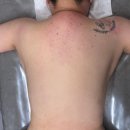 여우체형관리 | 부천상동체형비만관리 여우에스테틱 등, 목 통증관리 후기