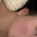 w-37 | [W.37 청담위드뷰티 주안 림프관리 후기]림프 순환·부종 완화, 청담의 기준을 주안에서