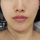 낙성대역 3번출구 | 낙성대역 피부관리 유채경 피부관리 웨딩 촬영 직전 세 번째 방문