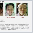 지니홈케어 이미지