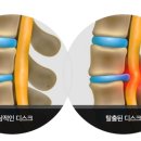 더디스크 이미지