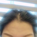 리젠셀의원 | 전라북도 정읍시 내장상동 대상포진 전문병원 추천 | 무료접종 | 예방접종