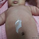 (주)다래테크 | [대표카페 지후맘 아토라떼 인텐시브 로션,크림 이벤트 체험 후기]민감성 피부 전용보습제품/아토라떼