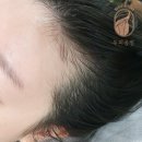 두피공방헤어라인